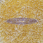 Filtration Media